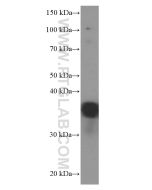 EEF1D Monoclonal antibody proteintech 60085-1-Ig