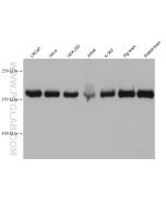 CLTC Monoclonal antibody proteintech 66487-1-Ig