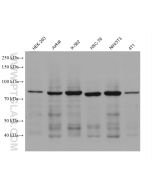 PI3 Kinase p85 Beta Monoclonal antibody proteintech 67644-1-Ig