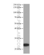ANGPTL8/Betatrophin Monoclonal antibody proteintech 66641-1-Ig