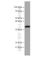 OLIG2 (for WB only) Monoclonal antibody proteintech 66513-1-Ig