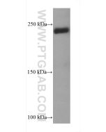 COL5A1 Monoclonal antibody proteintech 67604-1-Ig