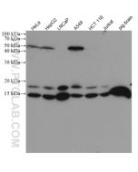 Neudesin/NENF Monoclonal antibody proteintech 60131-1-Ig