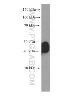 ESR2 Monoclonal antibody proteintech 60197-1-Ig