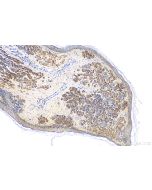Melan-A  Monoclonal antibody proteintech 60348-1-Ig