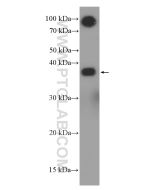 Glycophorin A/CD235a Monoclonal antibody proteintech 66778-1-Ig