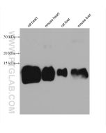 ATP5J2 Monoclonal antibody proteintech 68128-1-Ig