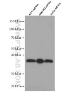 SMN (Human-Specific) Monoclonal antibody proteintech 60154-1-Ig