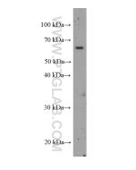Bestrophin-1 Monoclonal antibody proteintech 60326-1-Ig