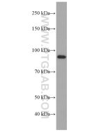 PHEX Monoclonal antibody proteintech 66934-1-Ig