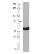 FTCD Monoclonal antibody proteintech 66979-1-Ig