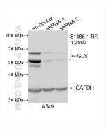 KGA/GAC Recombinant monoclonal antibody proteintech 81486-1-RR