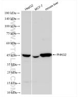 PHKG2 Recombinant monoclonal antibody Proteintech  83663-2-RR