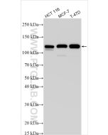 E-cadherin Recombinant monoclonal antibody proteintech 80541-7-RR