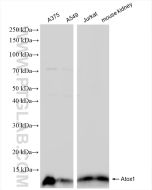 Atox1 Recombinant monoclonal antibody proteintech 84305-1-RR