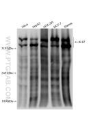Ki-67 Recombinant monoclonal antibody proteintech 84192-4-RR