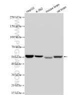 ALDH1B1 Recombinant monoclonal antibody proteintech 85426-2-RR