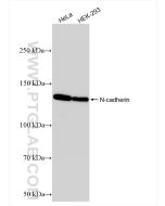 N-cadherin Recombinant monoclonal antibody proteintech 82968-1-RR