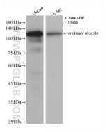 androgen receptor Recombinant monoclonal antibody proteintech 81844-1-RR
