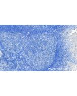 Anti-Human TNFRSF9/CD137 Rabbit Recombinant Antibody Proteintech  98112-1-RR