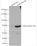 HSP70 Polyclonal antibody Proteintech  10995-1-AP