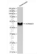 HORMAD1 Recombinant monoclonal antibody Proteintech  84003-5-RR