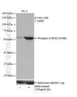 Phospho-CHEK2 (Thr68) Recombinant monoclonal antibody Proteintech  81740-1-RR