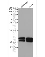 ALR Polyclonal antibody Proteintech  11293-1-AP
