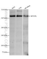 MYO7A Recombinant monoclonal antibody Proteintech  83807-1-RR