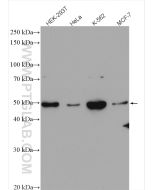Chk1 Polyclonal antibody Proteintech  25887-1-AP