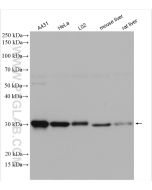 GCLM Polyclonal antibody Proteintech  14241-1-AP