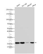 IL-18 Polyclonal antibody Proteintech  10663-1-AP