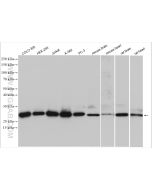 GSTP1 Polyclonal antibody Proteintech  15902-1-AP