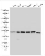 IkB Alpha Polyclonal antibody Proteintech  10268-1-AP