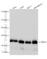 RBM10 Recombinant monoclonal antibody Proteintech  84104-2-RR