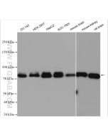 FOXO1 Polyclonal antibody Proteintech  18592-1-AP
