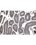 ELAC2 Polyclonal antibody 10071-1-AP proteintech