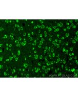 Recoverin Polyclonal antibody 10073-1-AP proteintech