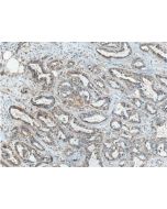 ICAM-2/CD102 Polyclonal antibody 10121-2-AP proteintech