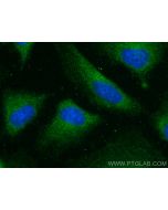 NKIRAS2 Polyclonal antibody 10174-1-AP proteintech