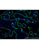Placental lactogen Polyclonal antibody 10178-1-AP proteintech