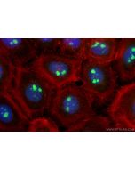 GNL2 Polyclonal antibody 10190-2-AP proteintech