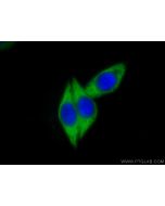EIF2S2 Polyclonal antibody 10227-1-AP proteintech