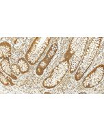 TCP1 alpha Polyclonal antibody 10320-1-AP proteintech