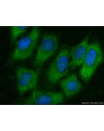 TRAIP Polyclonal antibody 10332-1-AP proteintech