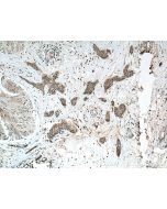 Calpain 3 Polyclonal antibody 10415-1-AP proteintech
