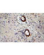 LAMA4 (Isoform 3) Polyclonal antibody 10465-1-AP proteintech