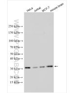 PPP1R2 Polyclonal antibody 10516-1-AP proteintech