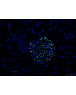Chromogranin A Polyclonal antibody 10529-1-AP proteintech
