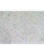 ITPK1 Polyclonal antibody 10568-1-AP proteintech